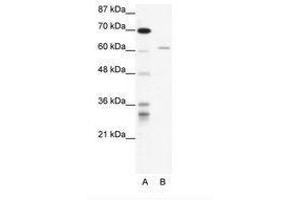Image no. 1 for anti-IKAROS Family Zinc Finger 4 (Eos) (IKZF4) (AA 97-146) antibody (ABIN202738) (IKZF4 Antikörper  (AA 97-146))