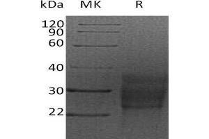 Western Blotting (WB) image for KIT Ligand (KITLG) protein (His tag) (ABIN7321269) (KIT Ligand Protein (KITLG) (His tag))