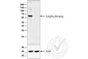 Image provided by the Independent Validation Program (badge number 29759). (Caspase 8 Antikörper  (AA 411-482))