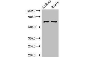 Western Blot Positive WB detected in: Mouse kidney tissue, Mouse brain tissue All lanes: GAA Antibody at 3 μg/mL Secondary Goat polyclonal to rabbit IgG at 1/50000 dilution Predicted band size: 70, 76, 106 kDa Observed band size: 70 kDa (GAA Antikörper  (AA 601-952))