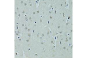 Immunohistochemistry of paraffin-embedded rat brain using ZNF346 antibody (ABIN5975303) at dilution of 1/100 (40x lens). (ZNF346 Antikörper)