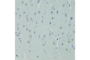 Immunohistochemistry of paraffin-embedded rat brain using ZNF346 antibody (ABIN5975303) at dilution of 1/100 (40x lens). (ZNF346 Antikörper)