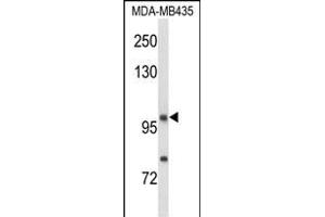 Western blot analysis of NRP1 Antibody (C-term) (ABIN653013 and ABIN2842638) in MDA-M cell line lysates (35 μg/lane). (Neuropilin 1 Antikörper  (C-Term))