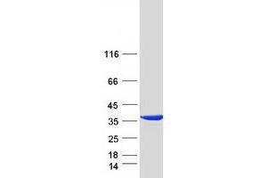 Western Blotting (WB) image for Mercaptopyruvate Sulfurtransferase (MPST) (Transcript Variant 2) protein (Myc-DYKDDDDK Tag) (ABIN2726302)