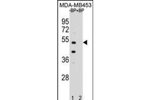 Western blot analysis of WDR51B Antibody (C-term) Pab (ABIN654969 and ABIN2844607) pre-incubated without(lane 1) and with(lane 2) blocking peptide in MDA-M cell line lysate. (POC1B Antikörper  (C-Term))