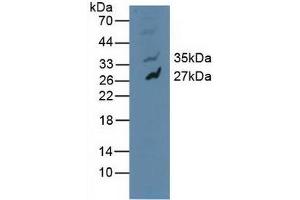 Detection of MAPK10 in Human U-87MG Cells using Polyclonal Antibody to Mitogen Activated Protein Kinase 10 (MAPK10) (MAPK10 Antikörper  (AA 88-332))