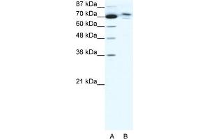 WB Suggested Anti-C14ORF101 Antibody Titration:  0. (C14orf101 Antikörper  (N-Term))