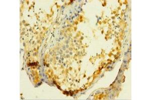 Immunohistochemistry of paraffin-embedded human testis tissue using ABIN7175117 at dilution of 1:100 (UCK1 Antikörper  (AA 1-201))