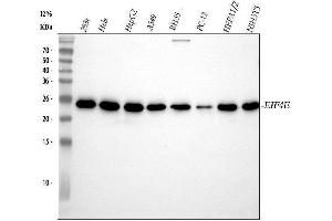 Western blot analysis of EIF4E using anti-EIF4E antibody (ABIN7603287).