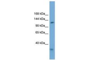 Image no. 1 for anti-Replication Factor C (Activator 1) 1, 145kDa (RFC1) (AA 935-984) antibody (ABIN6745691)