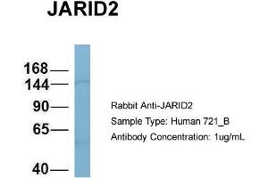 Host: Rabbit Target Name: JARID2 Sample Type: 721_B Antibody Dilution: 1. (JARID2 Antikörper  (N-Term))