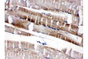 Immunohistochemistry (IHC) image for anti-Fatty Acid Binding Protein 3, Muscle and Heart (FABP3) (AA 119-133), (C-Term) antibody (ABIN3042627)