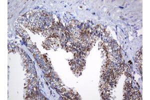 Image no. 6 for anti-NADH Dehydrogenase (Ubiquinone) 1 beta Subcomplex, 10, 22kDa (NDUFB10) antibody (ABIN1499672) (NDUFB10 Antikörper)