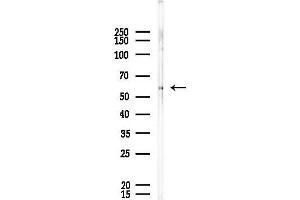 anti-Xylulokinase (XYLB) antibody
