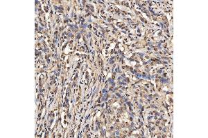 IHC analysis of SNRPA1 using anti-SNRPA1 antibody (ABIN7599131). (SNRPA1 Antikörper  (AA 1-233))