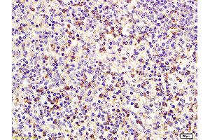Formalin-fixed and paraffin embedded human spleen labeled with Anti CD75 Polyclonal Antibody, Unconjugated (ABIN704201) at 1:200 followed by conjugation to the secondary antibody and DAB staining. (ST6GAL1 Antikörper  (AA 301-406))