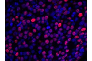 Immunofluorescence (IF) image for anti-Nuclear Casein Kinase and Cyclin-Dependent Kinase Substrate 1 (NUCKS1) (AA 1-50) antibody (ABIN7448993) (NUCKS1 Antikörper  (AA 1-50))