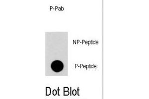 Dot Blot (DB) image for anti-Regulator of G-Protein Signalling 19 (RGS19) (pSer24) antibody (ABIN2971001) (RGS19 Antikörper  (pSer24))