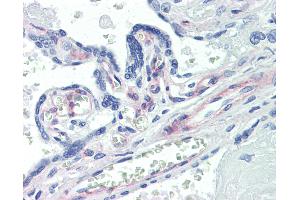 Anti-PDGFRB antibody IHC of human placenta. (PDGFRB Antikörper)