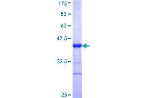 TP53AIP1 Protein (AA 1-108) (GST tag)