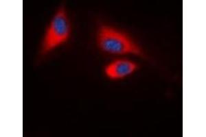 Immunofluorescent analysis of SHPTP1 (pY536) staining in HeLa cells. (SHPTP1 (C-Term), (pTyr536) Antikörper)