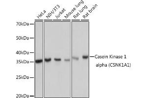 Western blot analysis of extracts of various cell lines, using Casein Kinase 1 alpha (Casein Kinase 1 alpha (CSNK1)) Rabbit mAb (ABIN7266098) at 1:1000 dilution. (CSNK1A1 Antikörper)