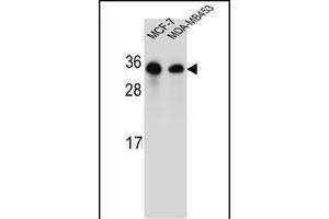 SAR1B Antibody (Center) (ABIN654355 and ABIN2844120) western blot analysis in MCF-7,MDA-M cell line lysates (35 μg/lane). (SAR1B Antikörper  (AA 89-116))