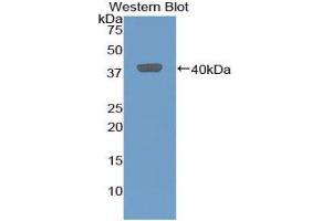 Detection of Recombinant GROb, Rat using Polyclonal Antibody to Chemokine (C-X-C Motif) Ligand 2 (CXCL2) (CXCL2 Antikörper  (AA 32-100))