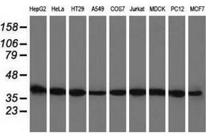 Western blot analysis of extracts (35 µg) from 9 different cell lines by using anti-BSG monoclonal antibody. (CD147 Antikörper)