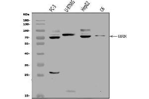 Western blot analysis of EEF2K using anti-EEF2K antibody (ABIN7600209).