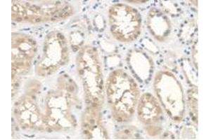 IHC-P analysis of Human Kidney Tissue, with DAB staining. (ANTXR2 Antikörper  (AA 34-318))