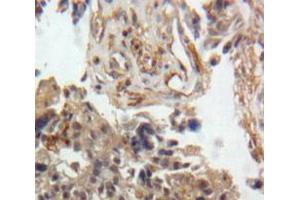 IHC-P analysis of Ovary tissue, with DAB staining. (GDF9 Antikörper  (AA 307-441))