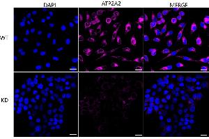 Immunocytochemical staining of HeLa cells using ATP2A2 antibody (ABIN7797694), 1:1,000), Top panel: wild-type (WT), Bottom panal: ATP2A2 shRNA knockdown (KD).