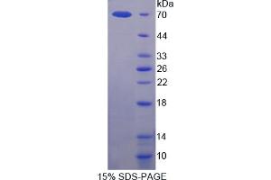 Image no. 1 for Sema Domain, Immunoglobulin Domain (Ig), Transmembrane Domain (TM) and Short Cytoplasmic Domain, (Semaphorin) 4D (SEMA4D) (AA 145-494) protein (His tag,GST tag) (ABIN6238243) (SEMA4D/CD100 Protein (AA 145-494) (His tag,GST tag))