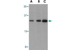 Western blot analysis of BAD in T24 cell lysates with BAD polyclonal antibody  at (A) 0. (BAD Antikörper  (C-Term))