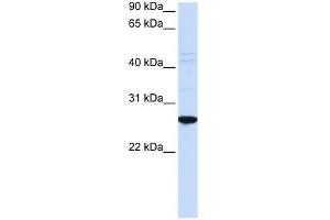 WB Suggested Anti-DRGX Antibody Titration:  0.