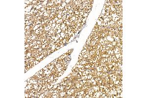 Immunohistochemistry (IHC) image for anti-Uncoupling Protein 1 (Mitochondrial, Proton Carrier) (UCP1) (AA 1-307) antibody (ABIN6149883)