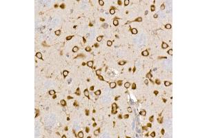 Immunohistochemistry of paraffin-embedded rat brain using Sterol carrier protein 2 Rabbit mAb (ABIN7270597) at dilution of 1:100 (40x lens). (SCP2 Antikörper)