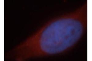 Immunofluorescence (IF) image for anti-Hepatic and Glial Cell Adhesion Molecule (HEPACAM) antibody (ABIN2932707) (HEPACAM Antikörper)