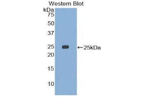 Western Blotting (WB) image for anti-Structural Maintenance of Chromosomes 3 (SMC3) (AA 994-1181) antibody (ABIN1860595) (SMC3 Antikörper  (AA 994-1181))