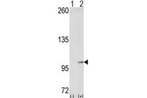 Western Blotting (WB) image for anti-EPH Receptor A4 (EPHA4) antibody (ABIN3003330) (EPH Receptor A4 Antikörper)
