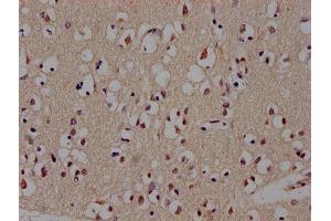 Immunohistochemistry of paraffin-embedded human brain tissue using ABIN7145172 at dilution of 1:300 (BCL11B Antikörper  (AA 500-550))