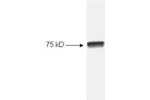 Image no. 1 for anti-Nuclear Factor-kB p65 (NFkBP65) (C-Term) antibody (ABIN221155) (NF-kB p65 Antikörper  (C-Term))
