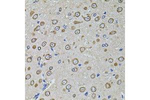 Immunohistochemistry of paraffin-embedded rat brain using EIF4A2 antibody. (EIF4A2 Antikörper  (AA 1-270))