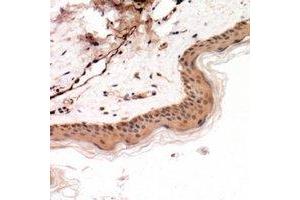 Immunohistochemical analysis of Cytokeratin 14/17 staining in human skin formalin fixed paraffin embedded tissue section. (Cytokeratin 14/17 Antikörper)