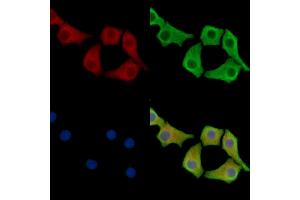 anti-Chromosome 3 Open Reading Frame 34 (C3orf34) antibody