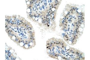NOL6 antibody was used for immunohistochemistry at a concentration of 16. (Nucleolar Protein 6 Antikörper)