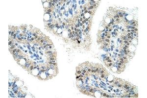 NOL6 antibody was used for immunohistochemistry at a concentration of 16.