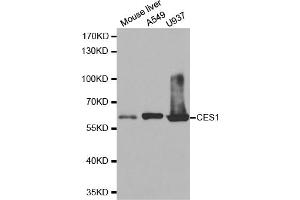Western blot analysis of extracts of various cell lines, using CES1 antibody. (CES1 Antikörper)