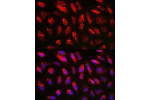 Immunofluorescence analysis of U2OS cells using TGF beta 1 antibody (ABIN7270909) at dilution of 1:150. (TGFB1 Antikörper  (AA 30-278))